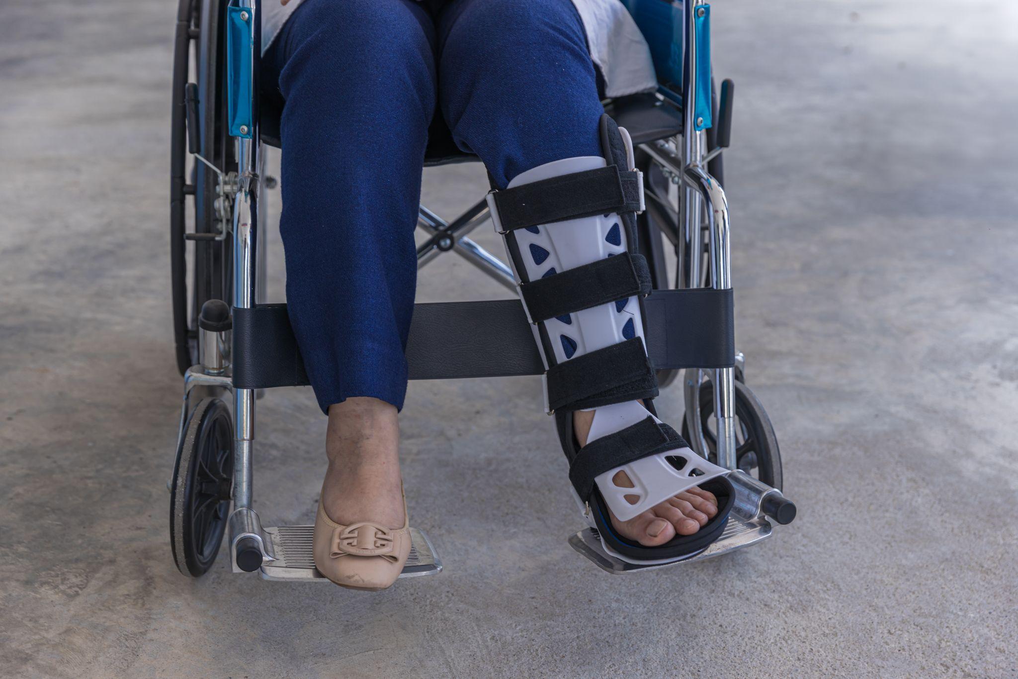 woman with foot brace