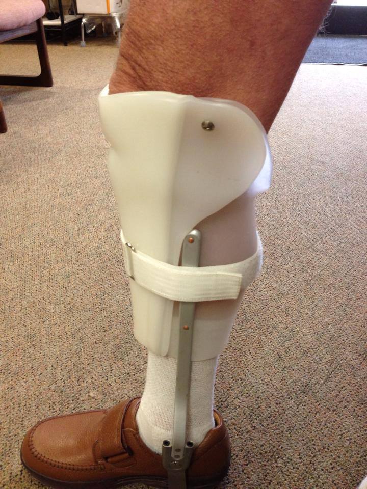 A patient wearing a custom ankle-foot orthotic brace fitted through expert custom orthotic fabrication in South Texas.