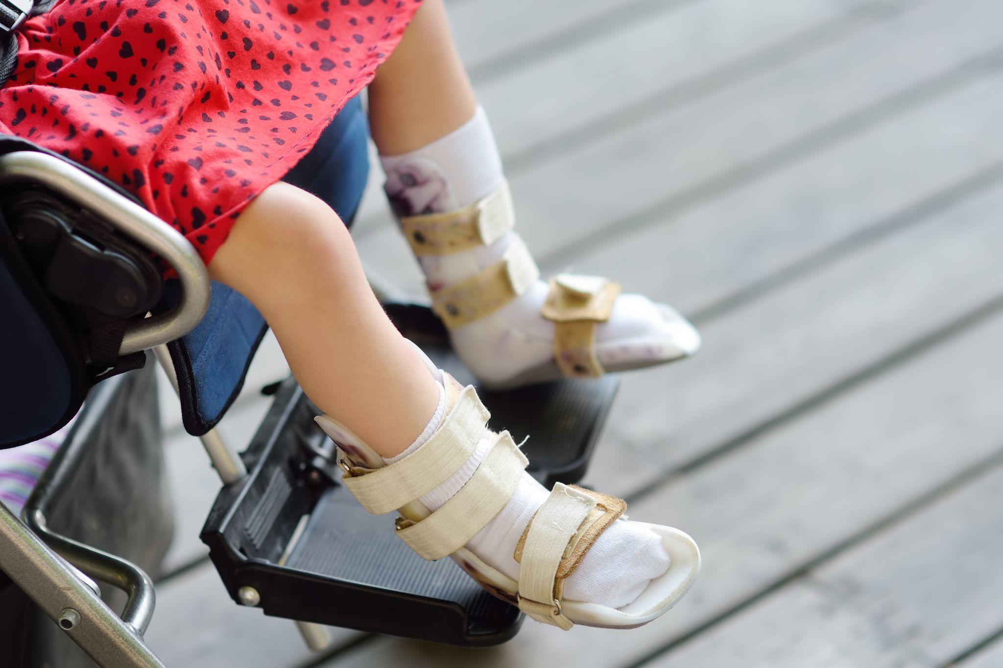 foot brace